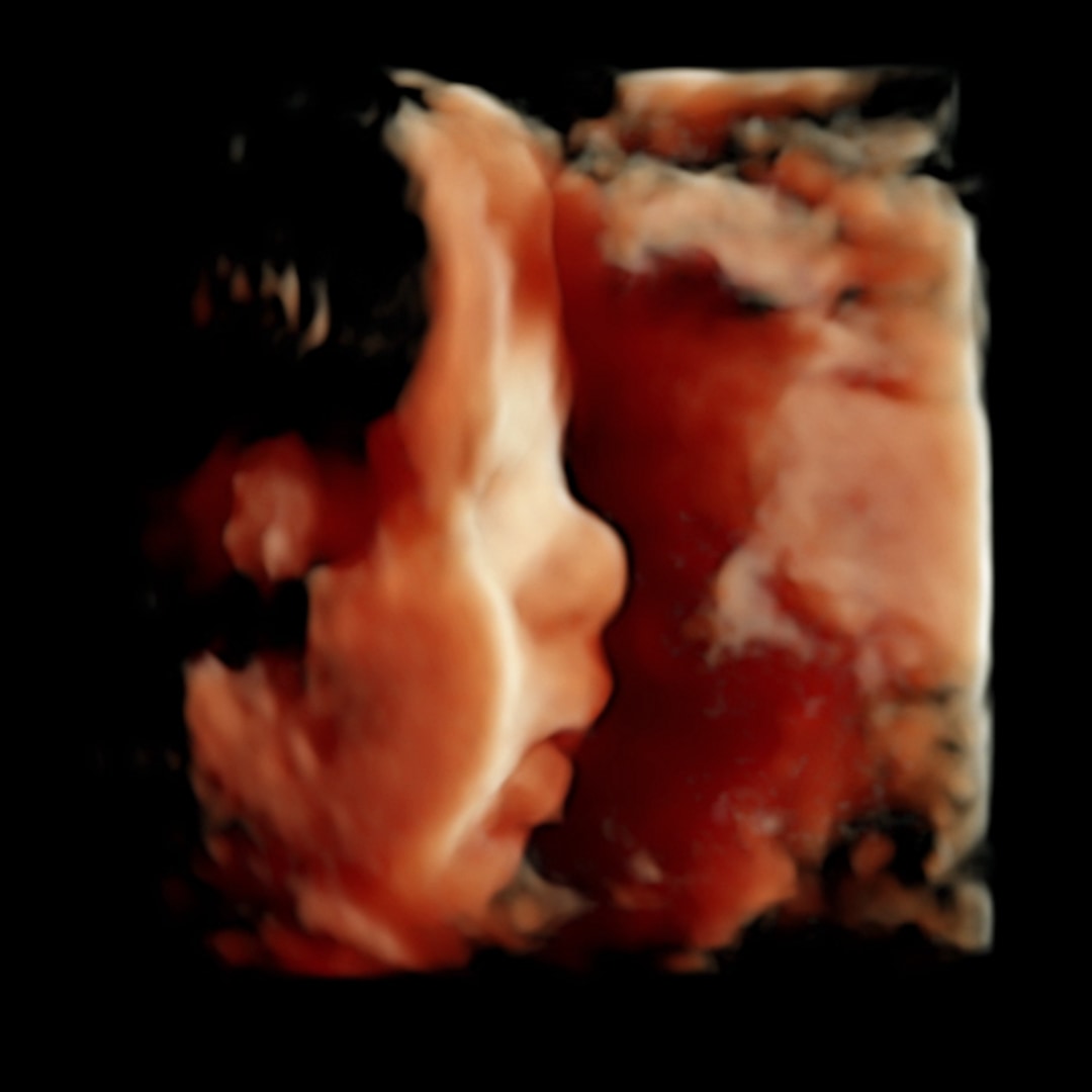 Photo shared by Abigail for their Babylist baby registry.