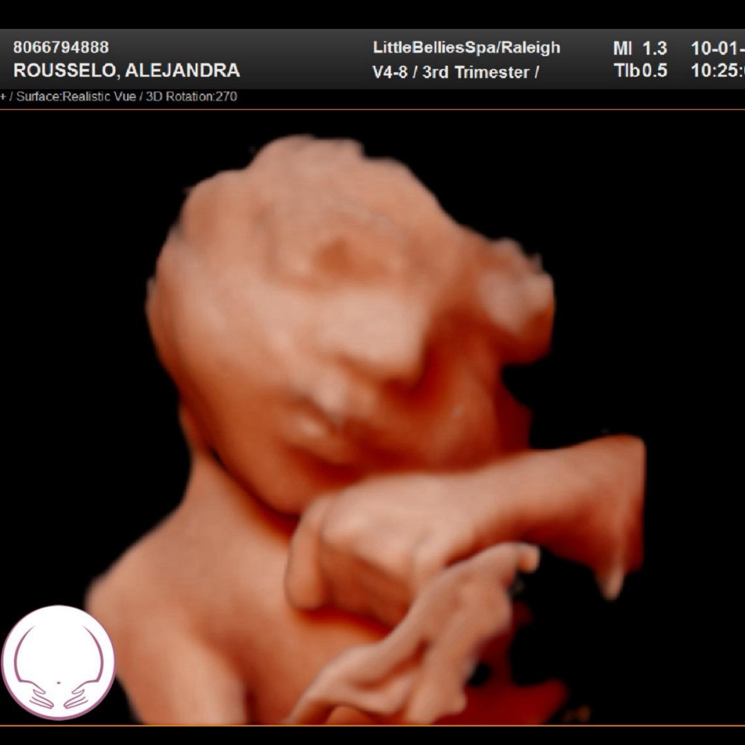 Photo shared by Ali for their Babylist baby registry.