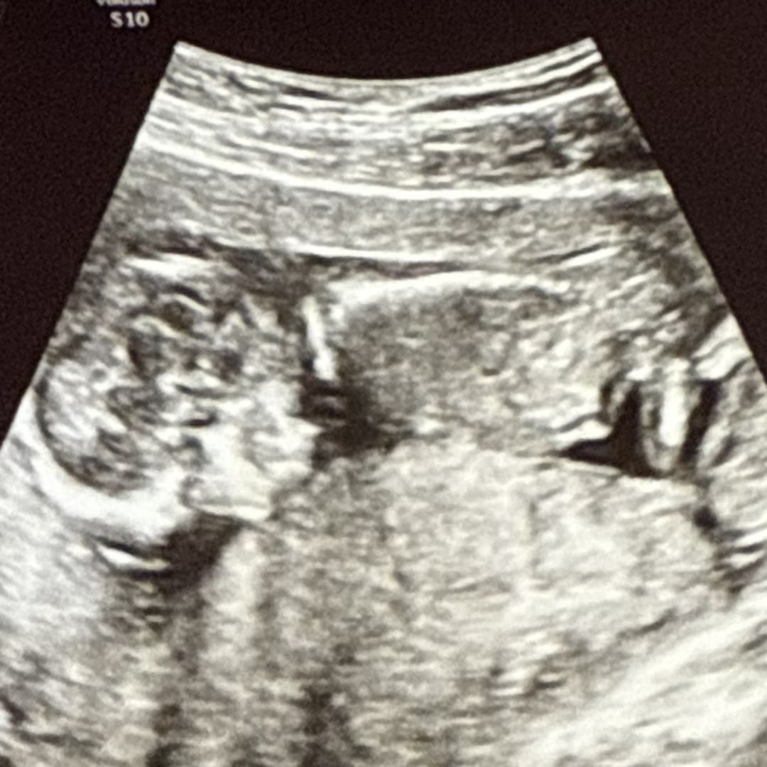 Photo shared by Danielle for their Babylist baby registry.