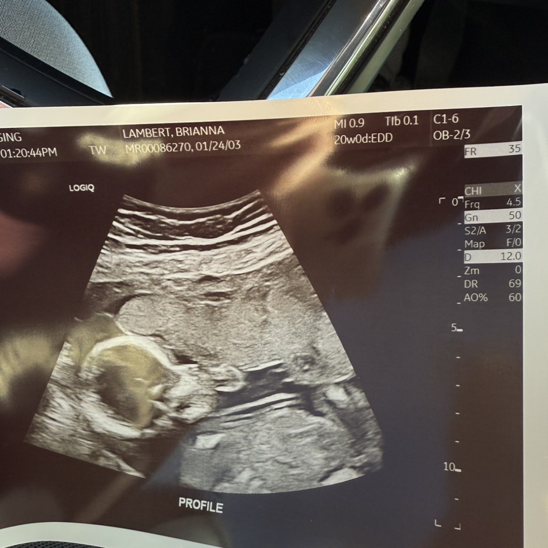 Photo shared by Brianna for their Babylist baby registry.