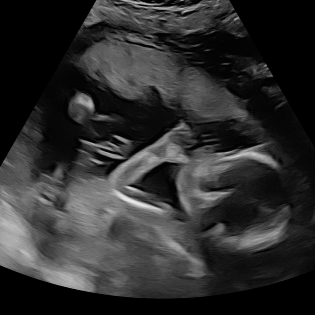 Photo shared by Abigail for their Babylist baby registry.
