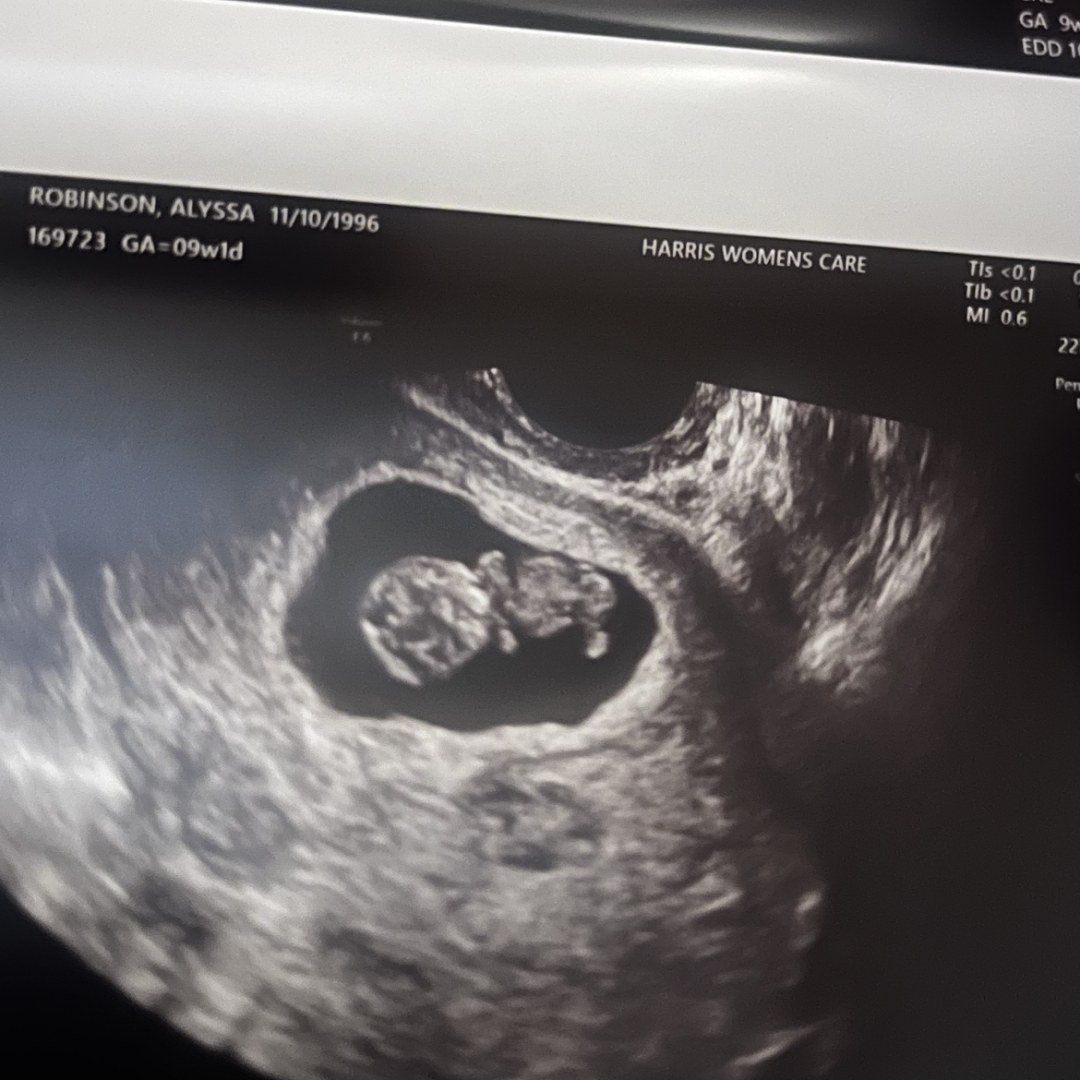 Photo shared by Alyssa for their Babylist baby registry.