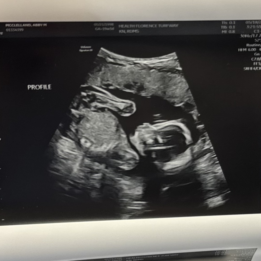 Photo shared by Abby for their Babylist baby registry.