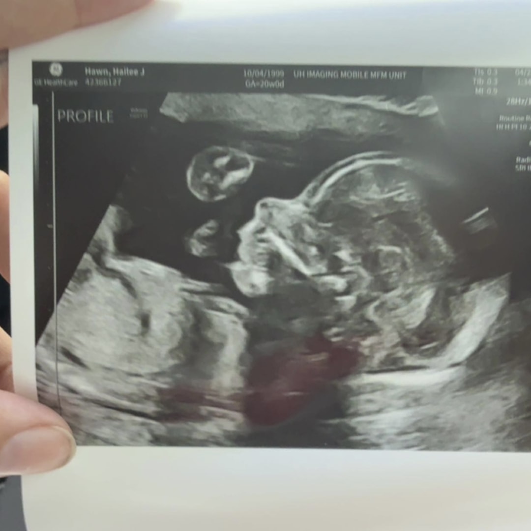 Photo shared by Hailee for their Babylist baby registry.