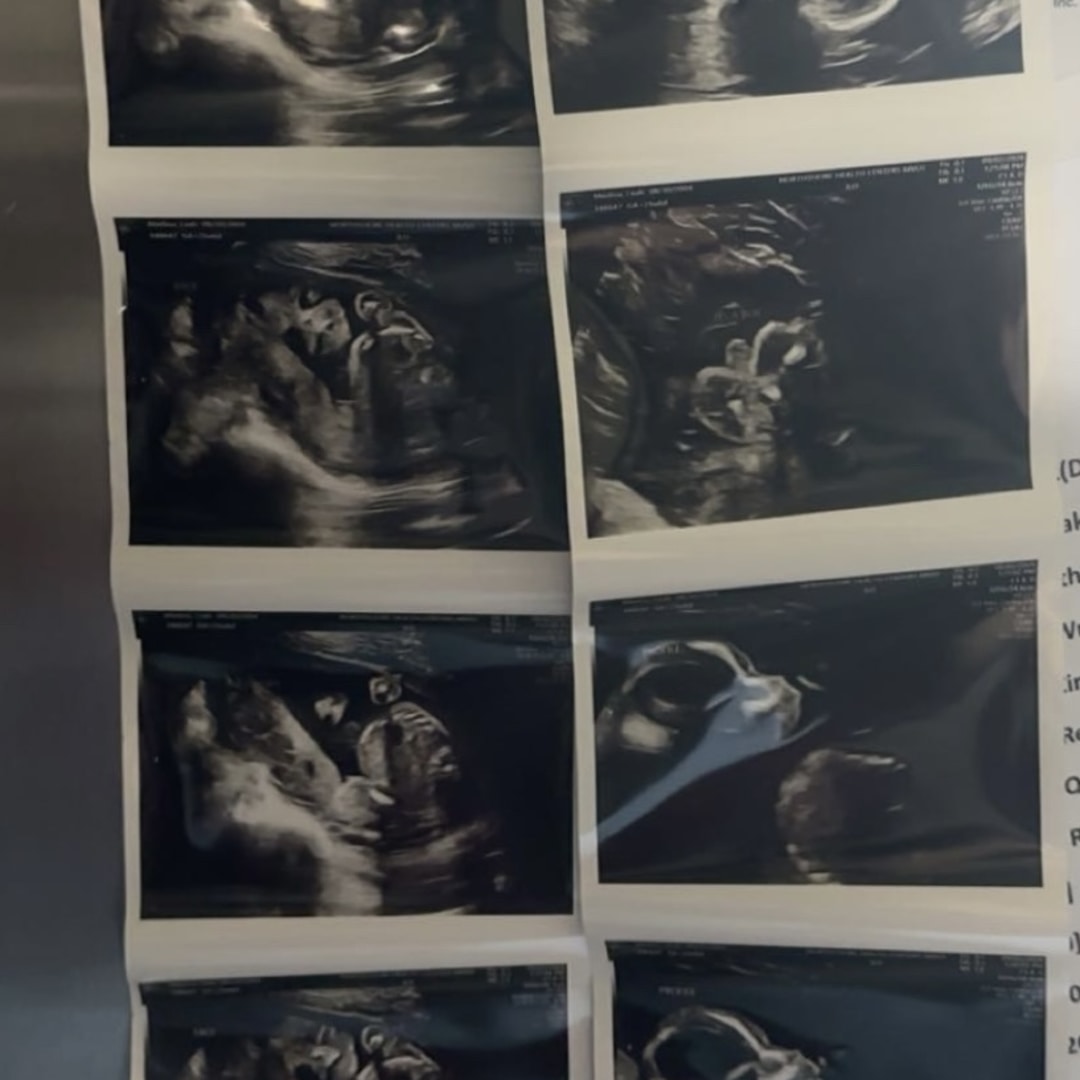 Photo shared by Leah for their Babylist baby registry.