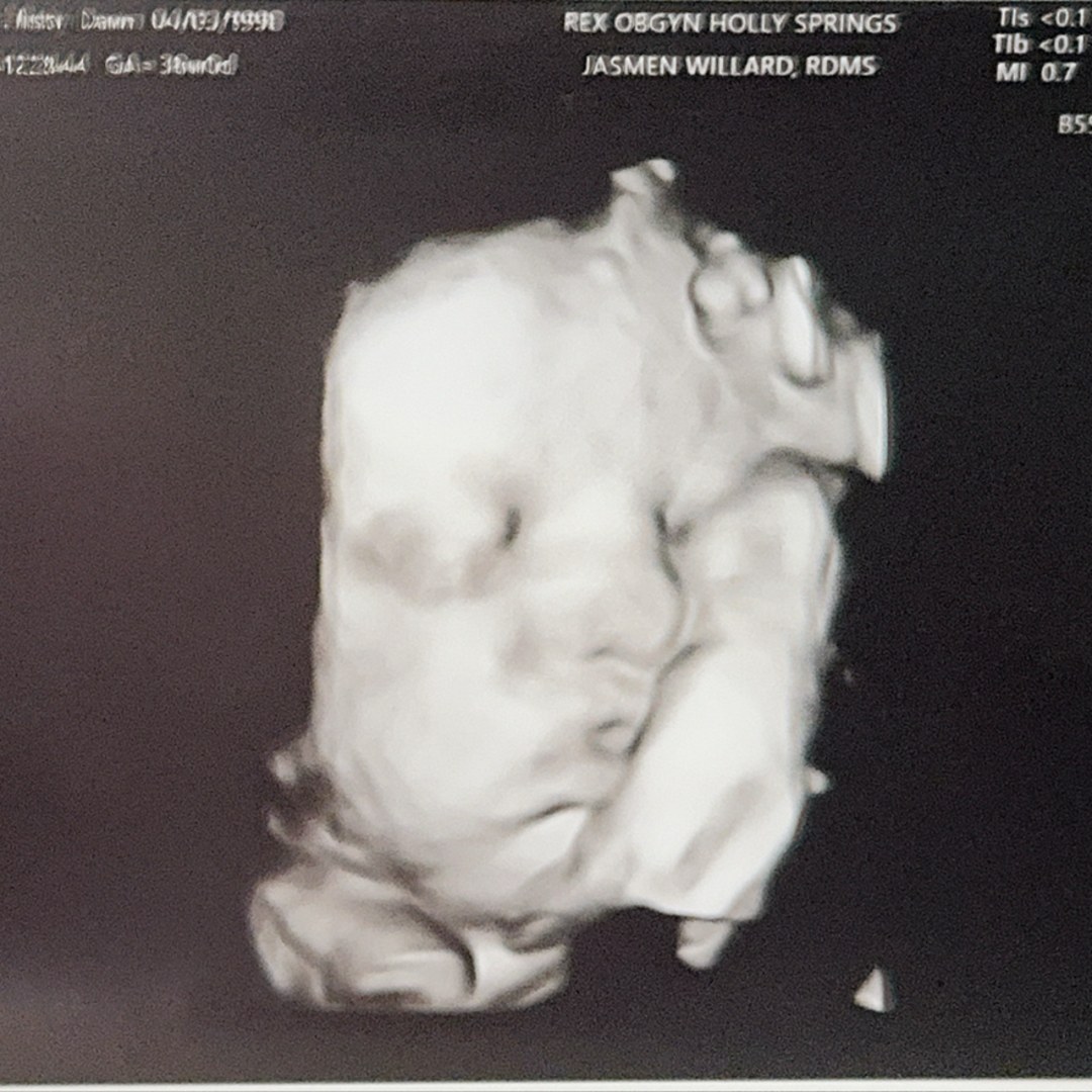 Photo shared by Misty for their Babylist baby registry.