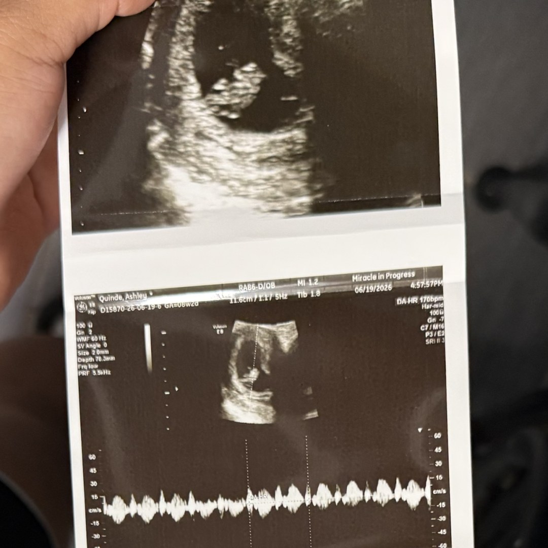 Photo shared by Ashley for their Babylist baby registry.