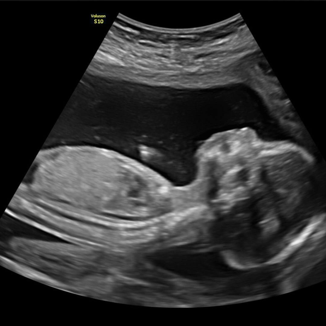 Photo shared by Dani for their Babylist baby registry.