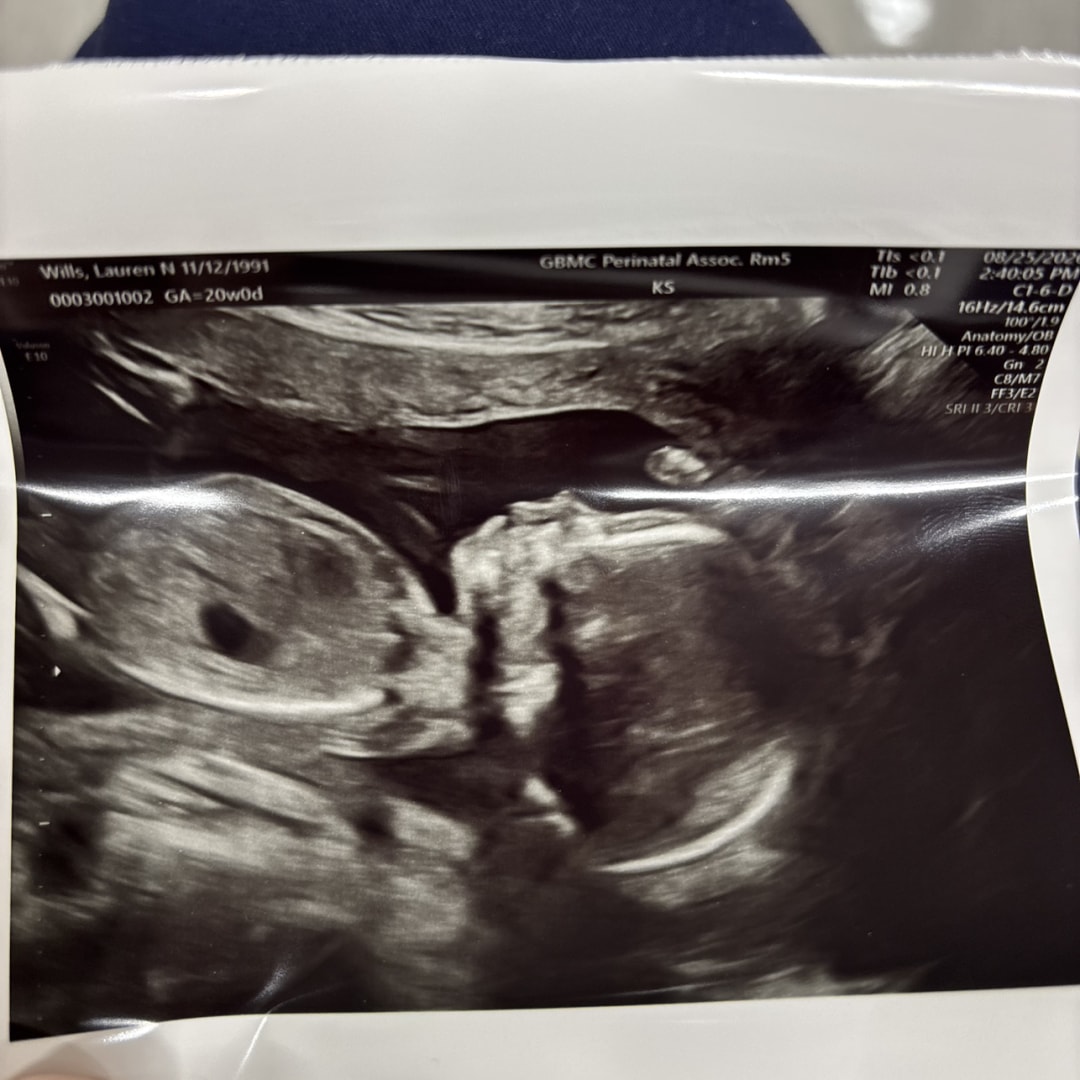 Photo shared by Lauren for their Babylist baby registry.