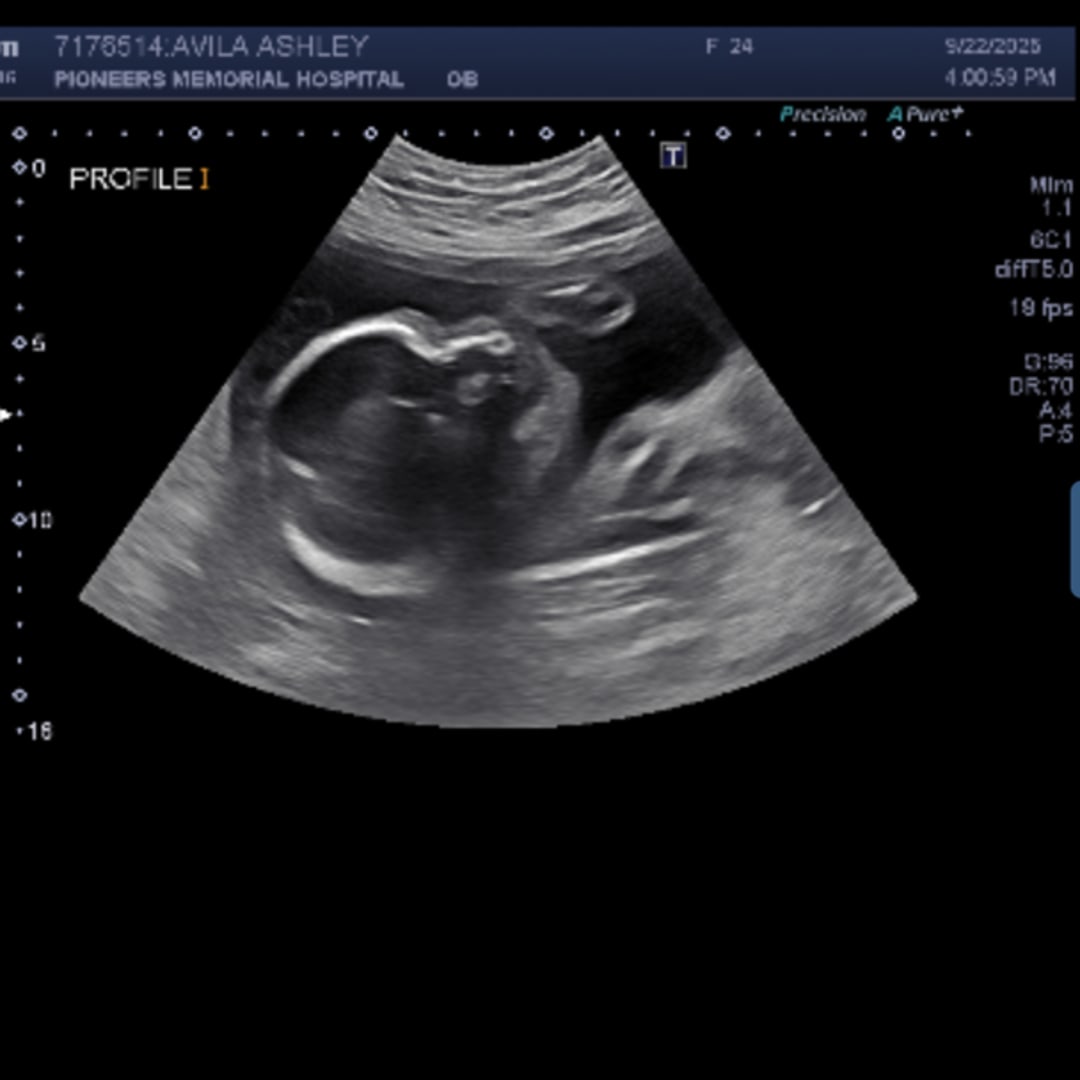 Photo shared by Ashley for their Babylist baby registry.