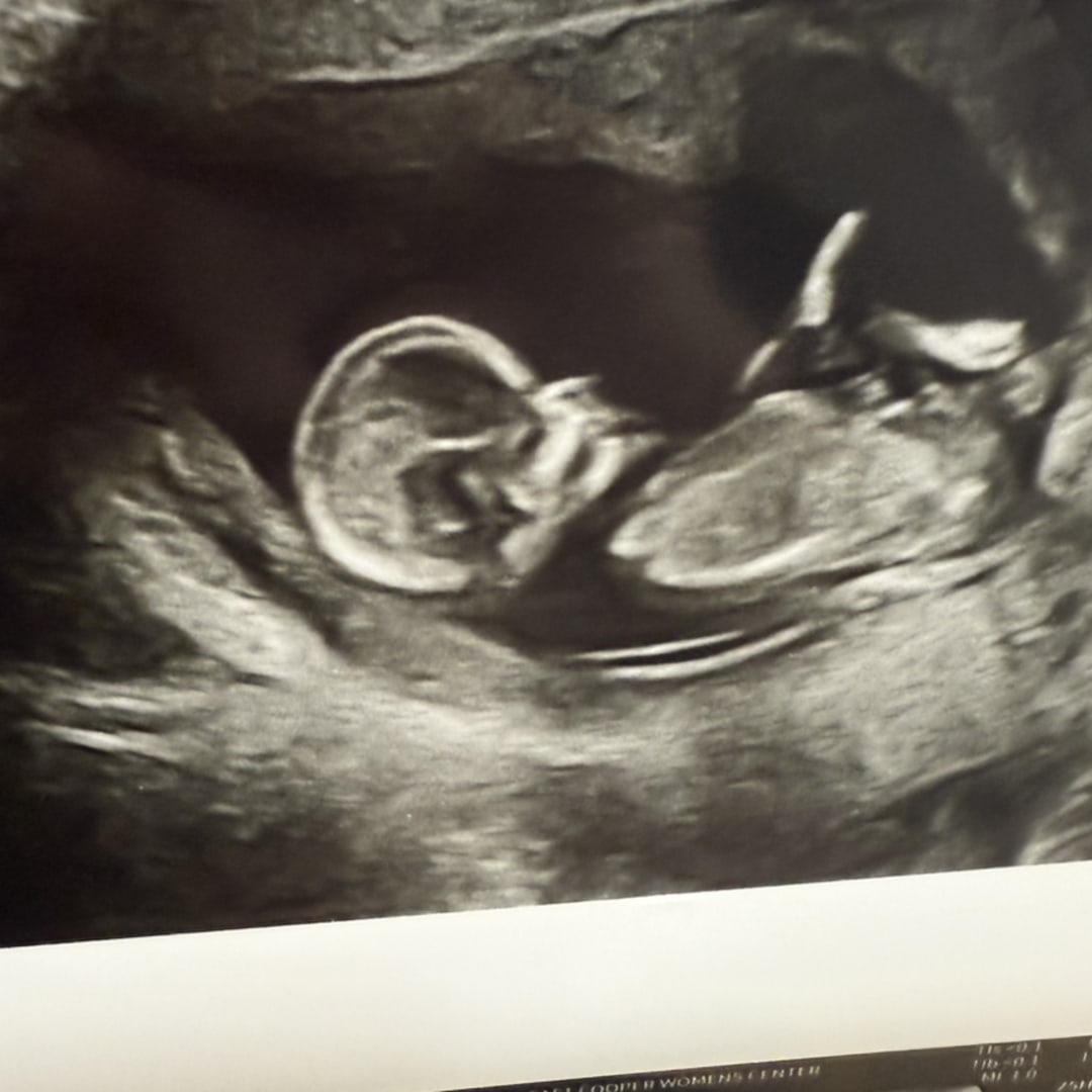 Photo shared by Brooke for their Babylist baby registry.