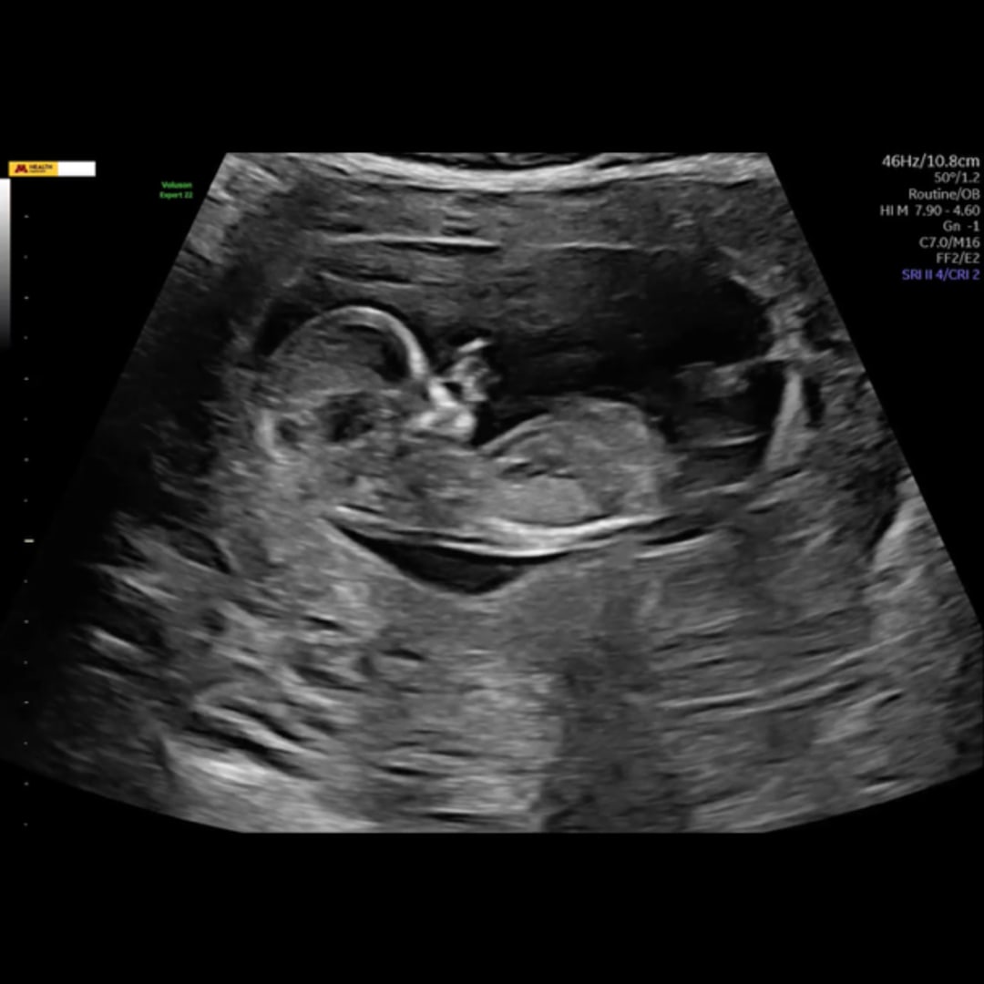 Photo shared by Baylee & Thomas for their Babylist baby registry.
