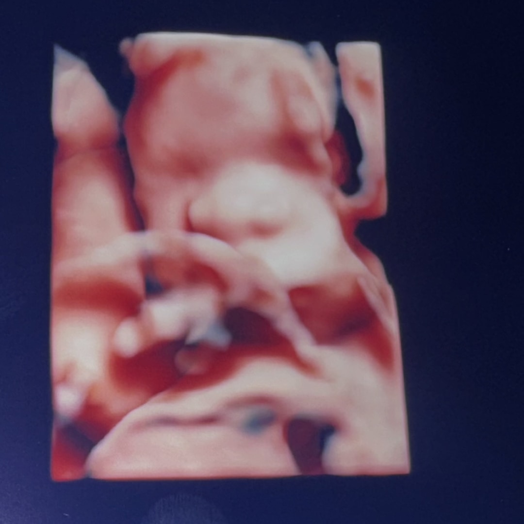 Photo shared by Celeste for their Babylist baby registry.