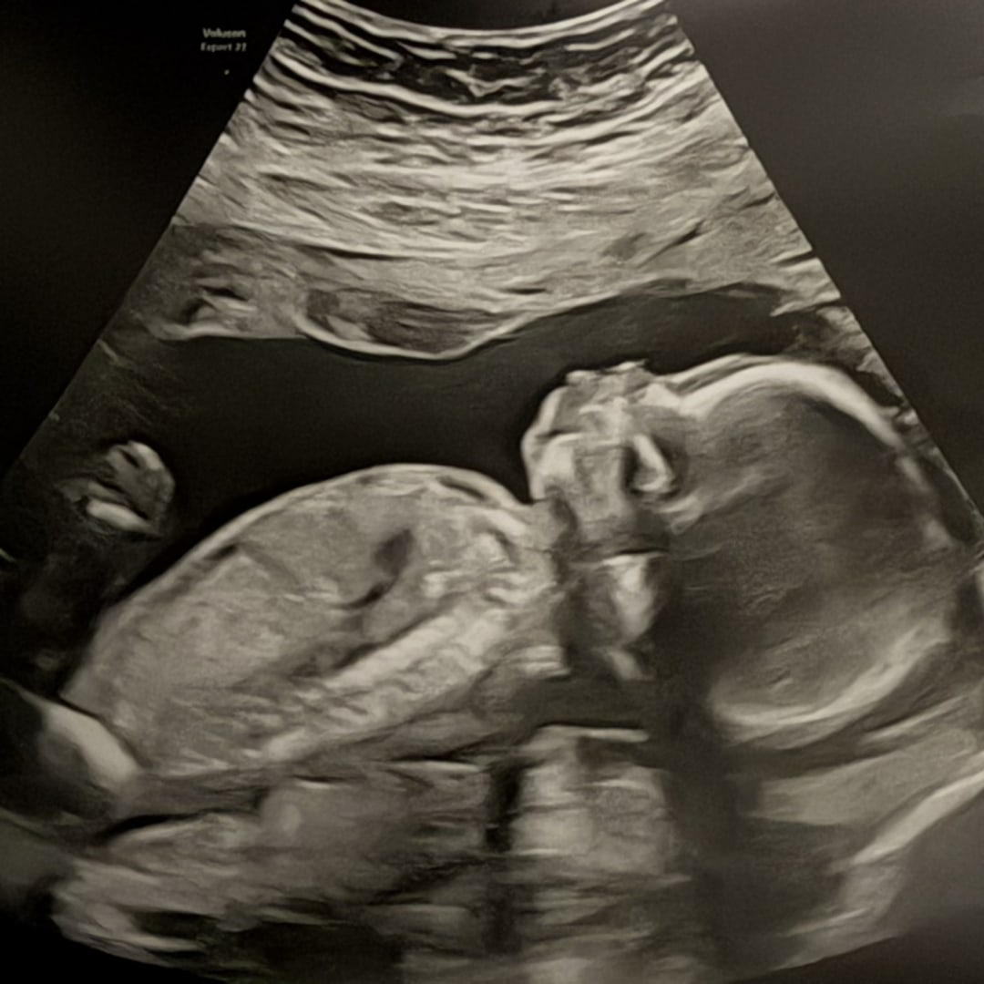 Photo shared by Ann Shelley for their Babylist baby registry.