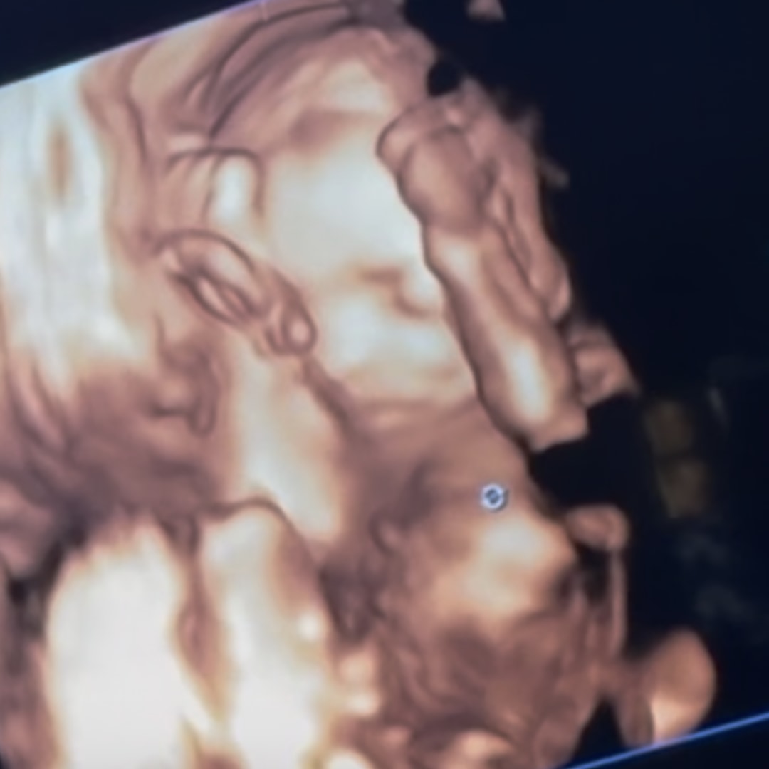 Photo shared by Gloria for their Babylist baby registry.