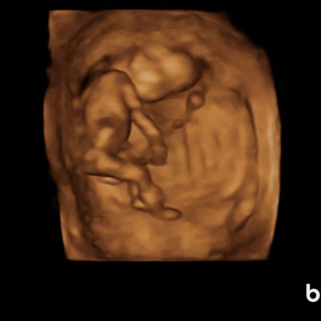 Photo shared by Allison for their Babylist baby registry.