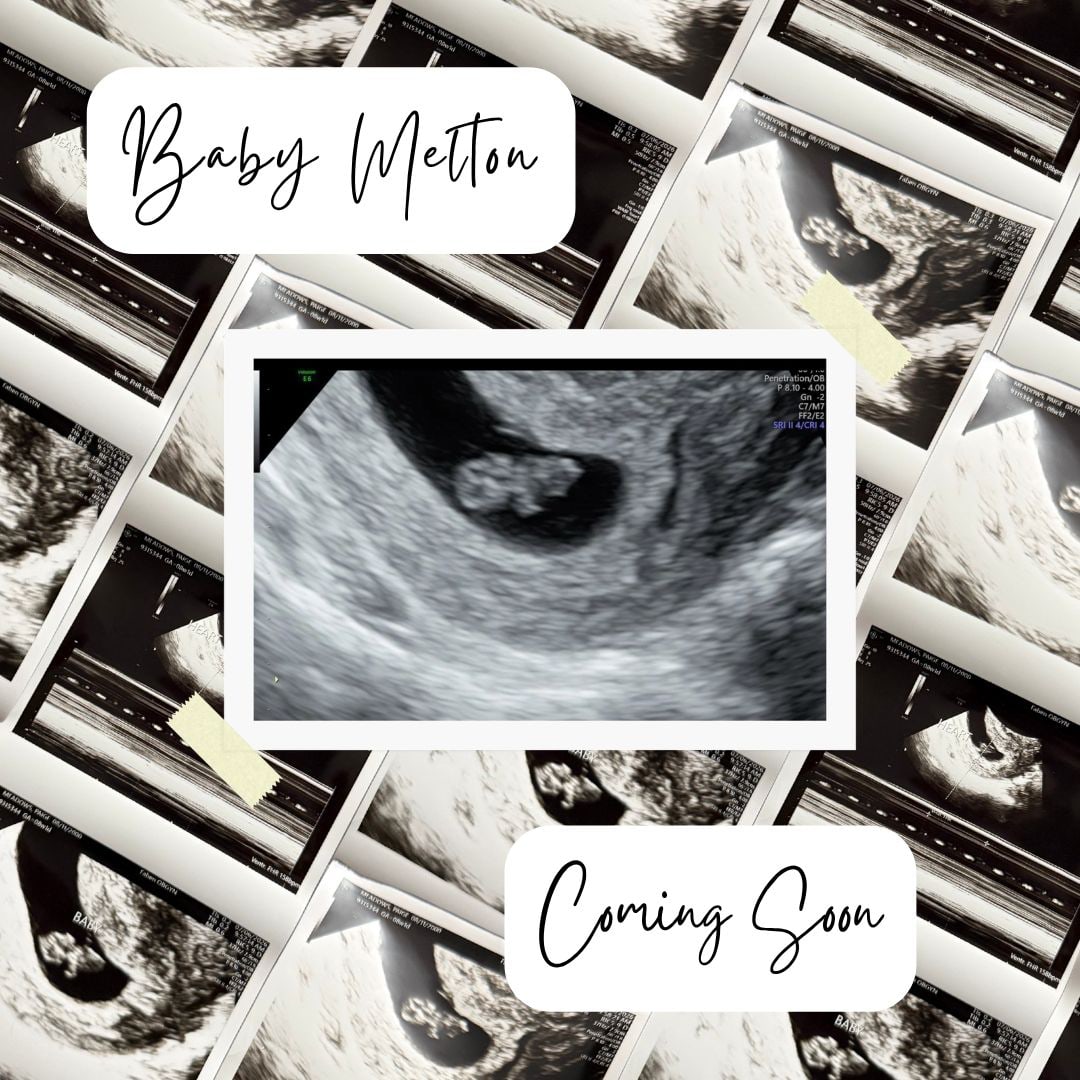 Photo shared by Paige for their Babylist baby registry.
