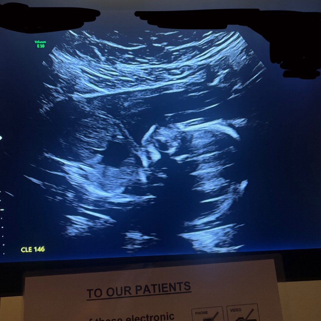 Photo shared by Amy for their Babylist baby registry.