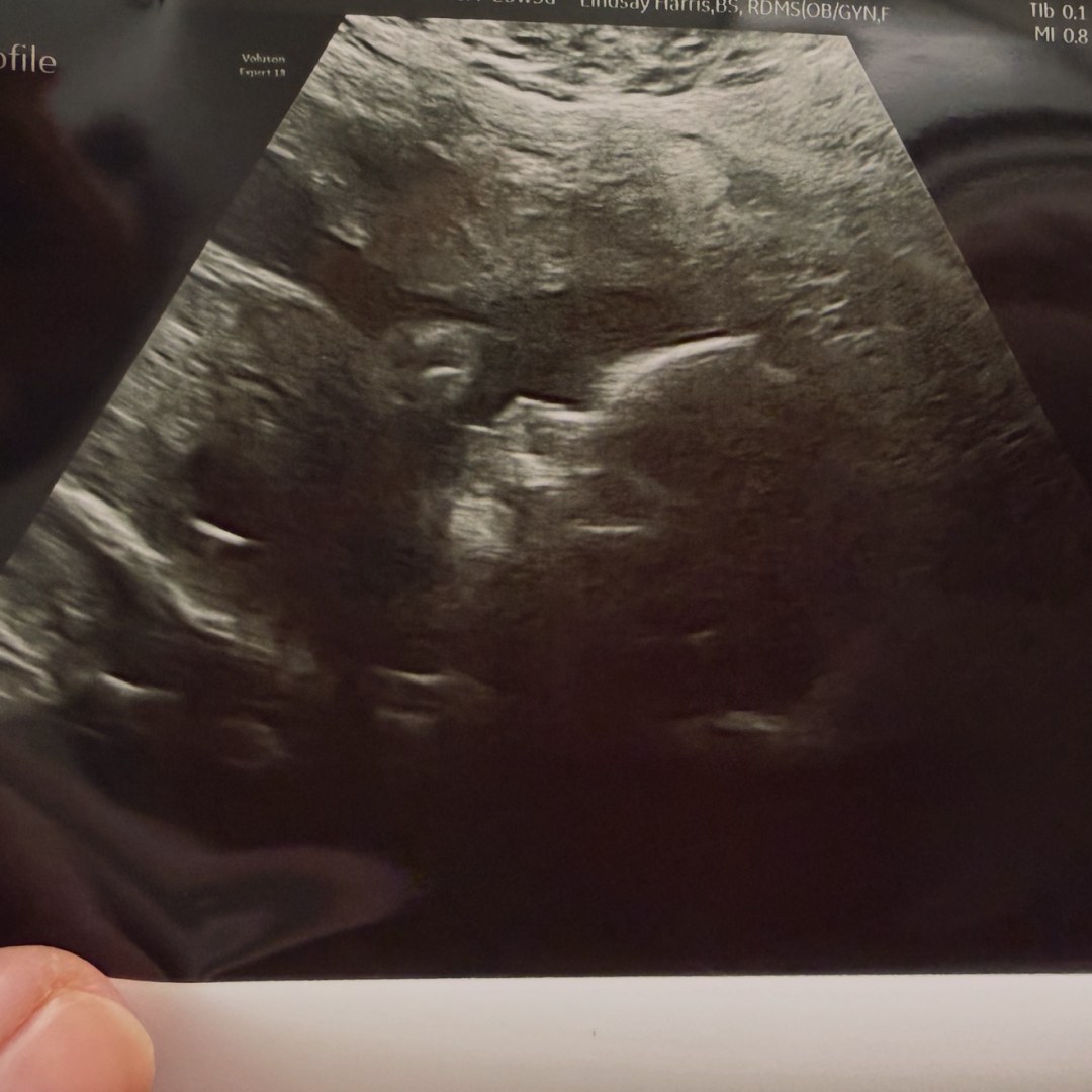 Photo shared by Tabatha for their Babylist baby registry.