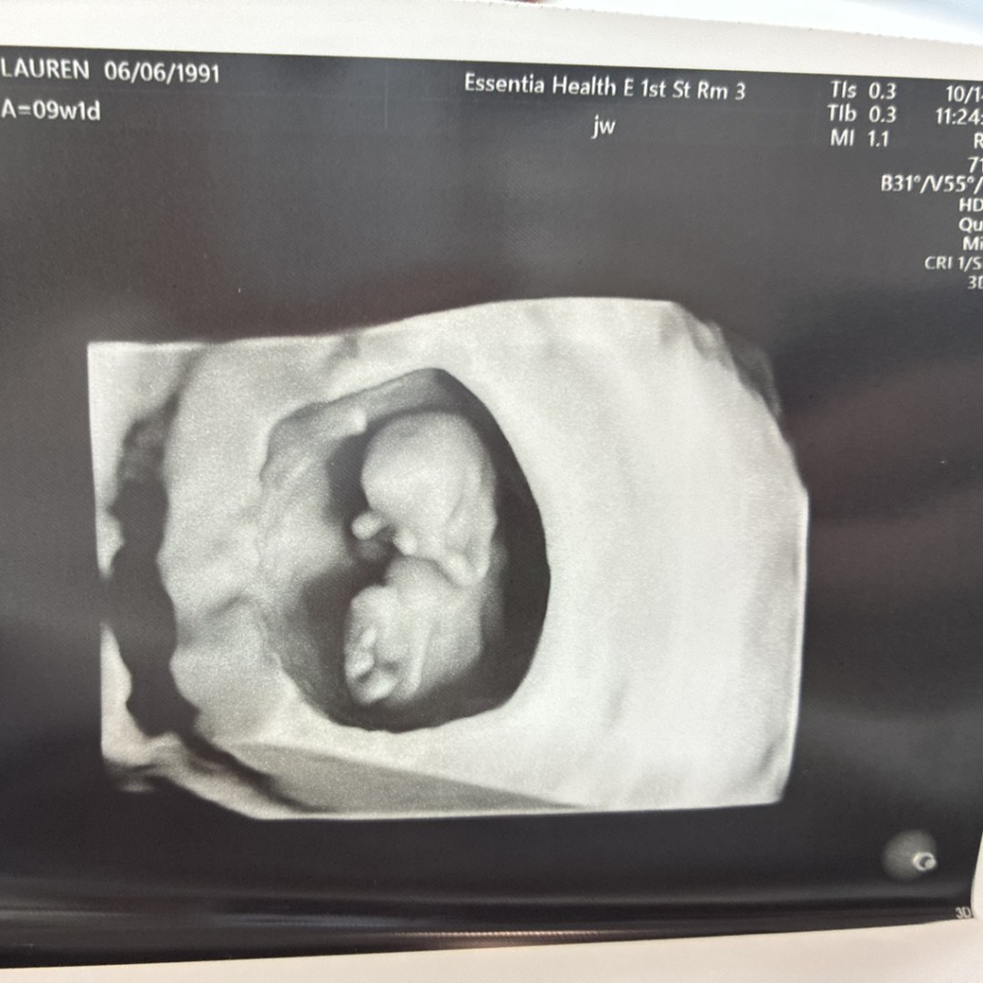 Photo shared by Lauren for their Babylist baby registry.