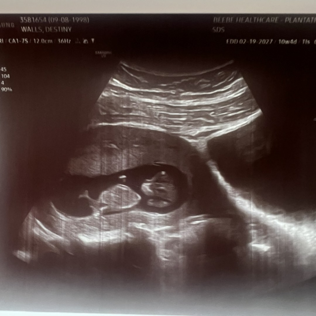 Photo shared by Destiny for their Babylist baby registry.