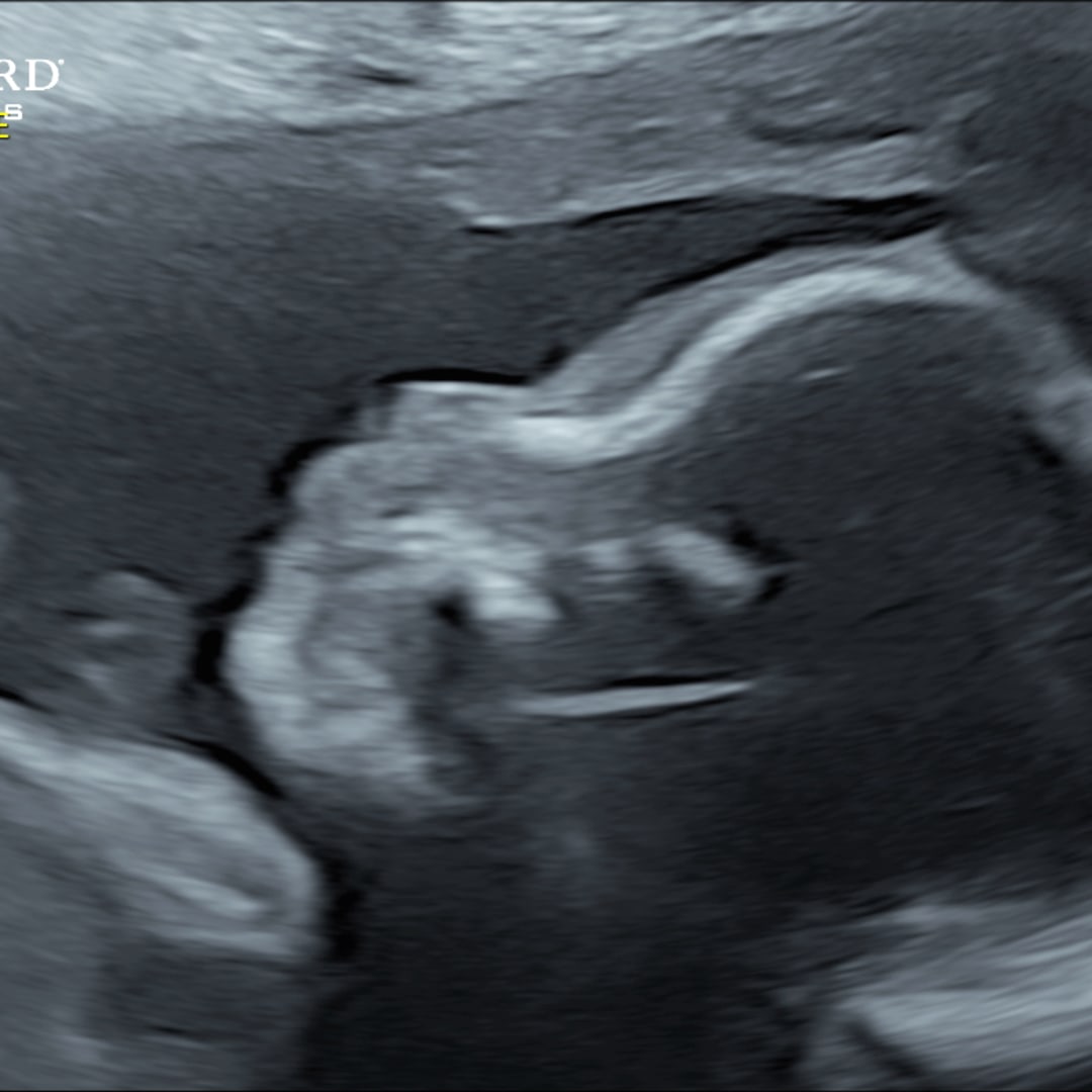 Photo shared by Aaron for their Babylist baby registry.