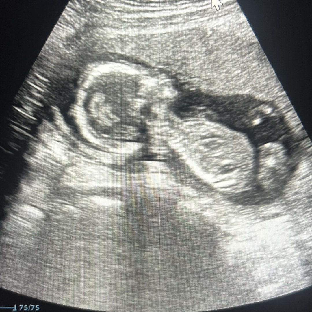 Photo shared by Darby for their Babylist baby registry.