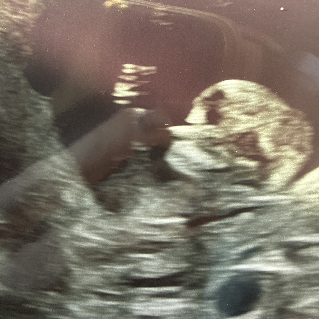 Photo shared by Addyson for their Babylist baby registry.