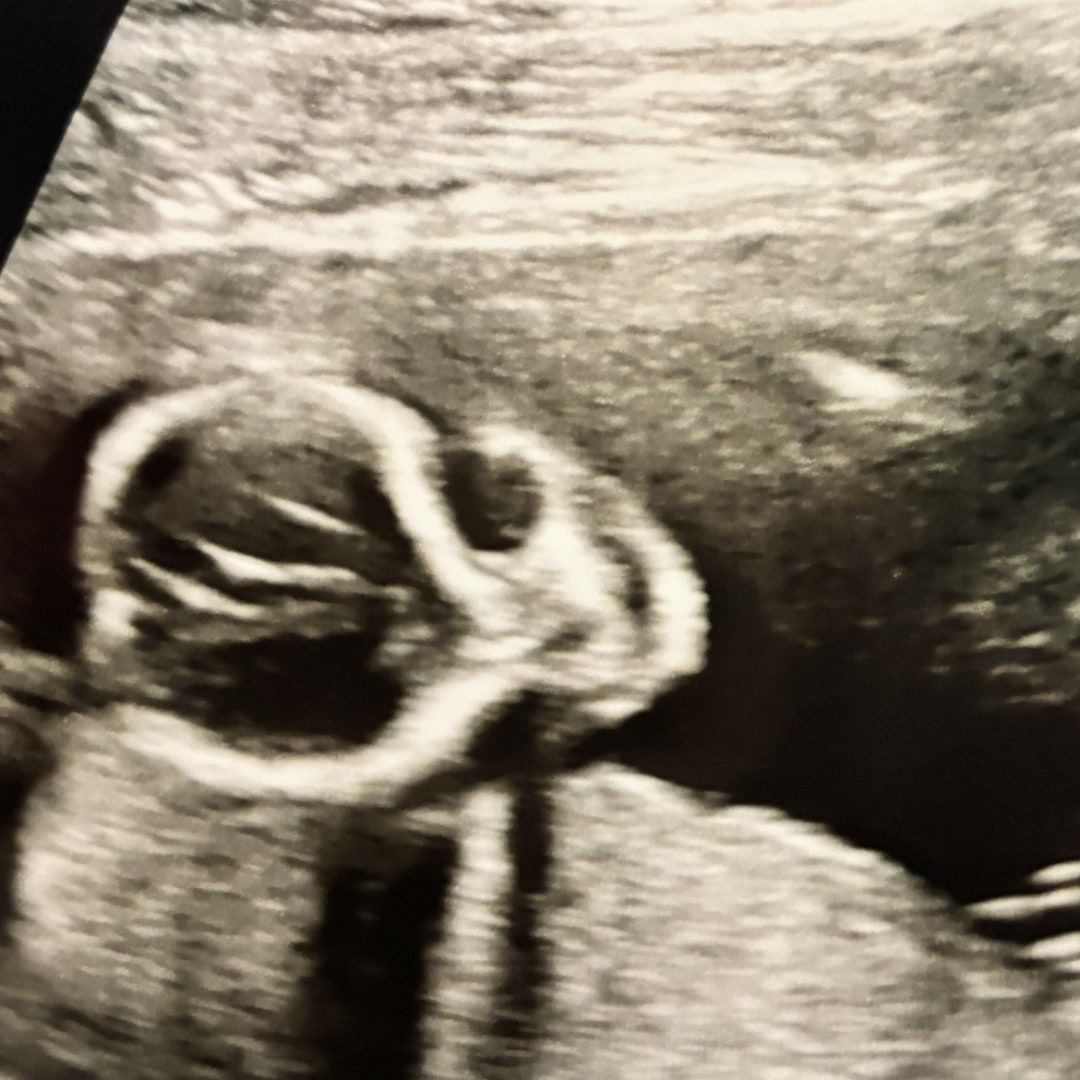 Photo shared by DeLenn for their Babylist baby registry.