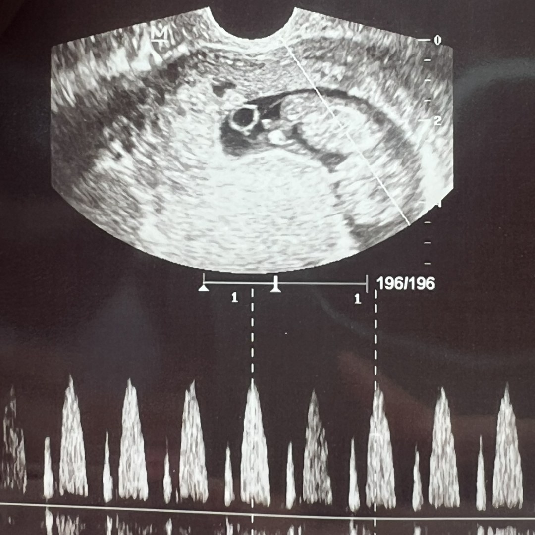 Photo shared by Amber for their Babylist baby registry.