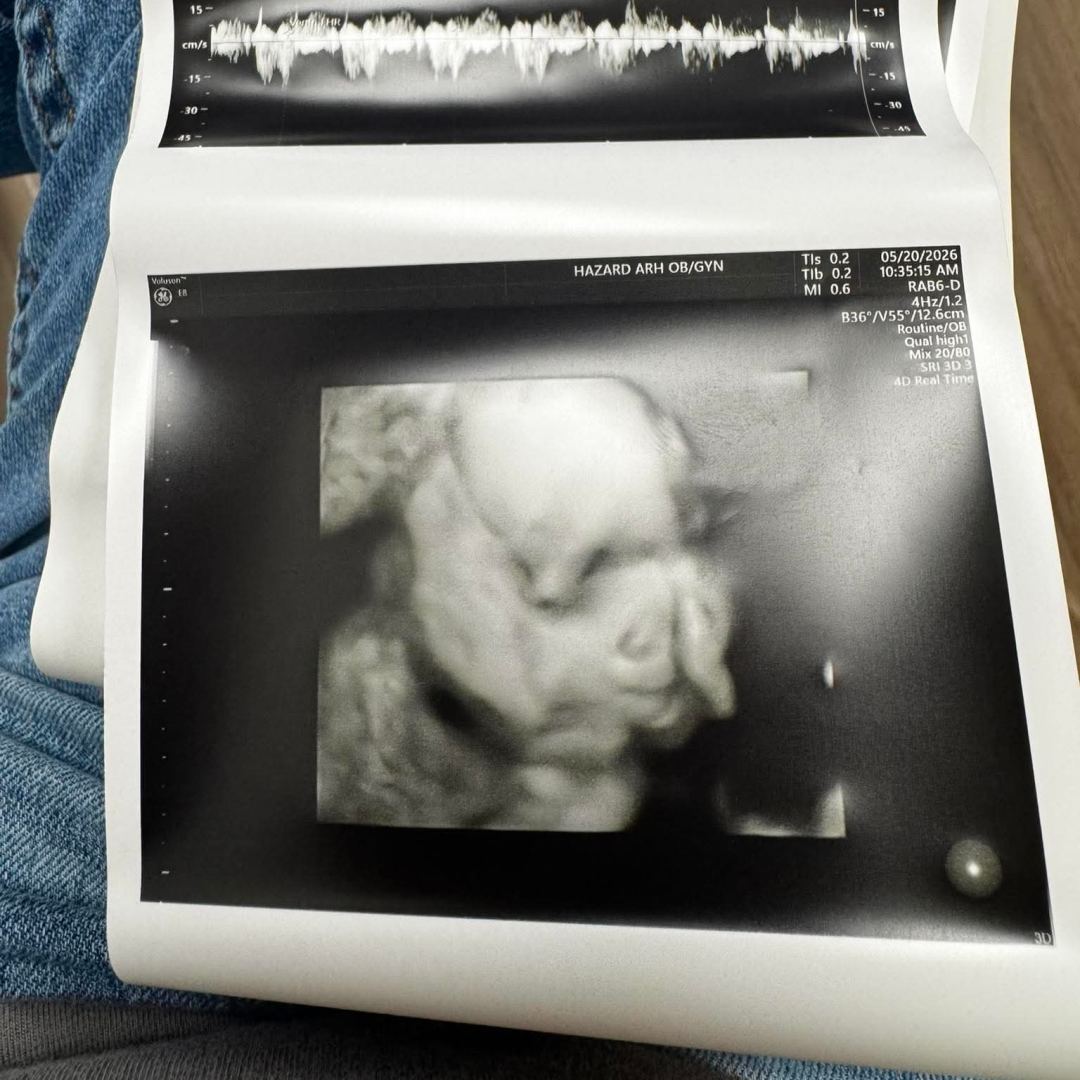 Photo shared by Amber for their Babylist baby registry.