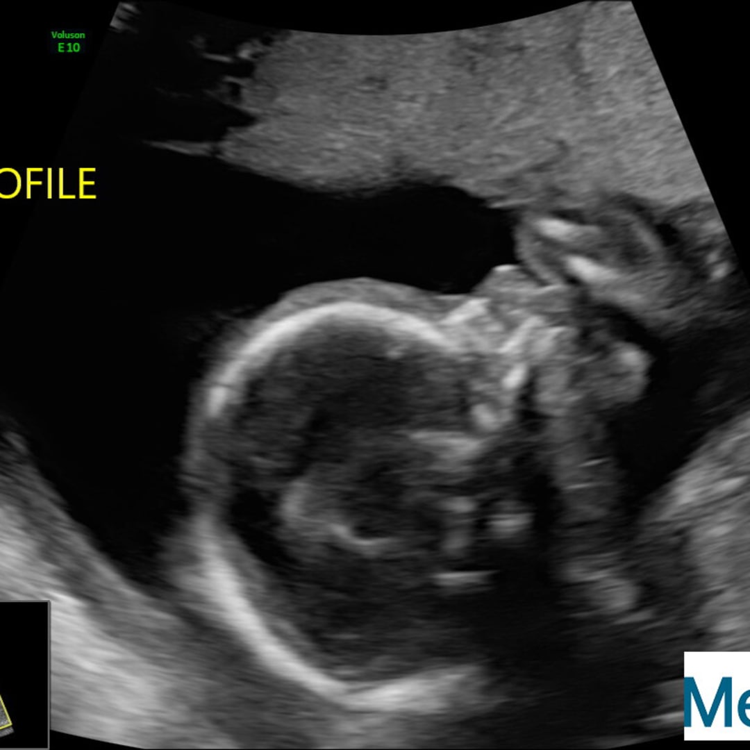 Photo shared by Jaira for their Babylist baby registry.