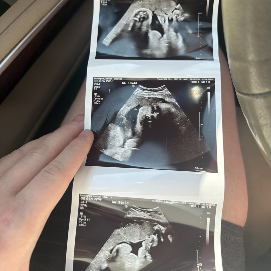 Photo shared by Hannah for their Babylist baby registry.