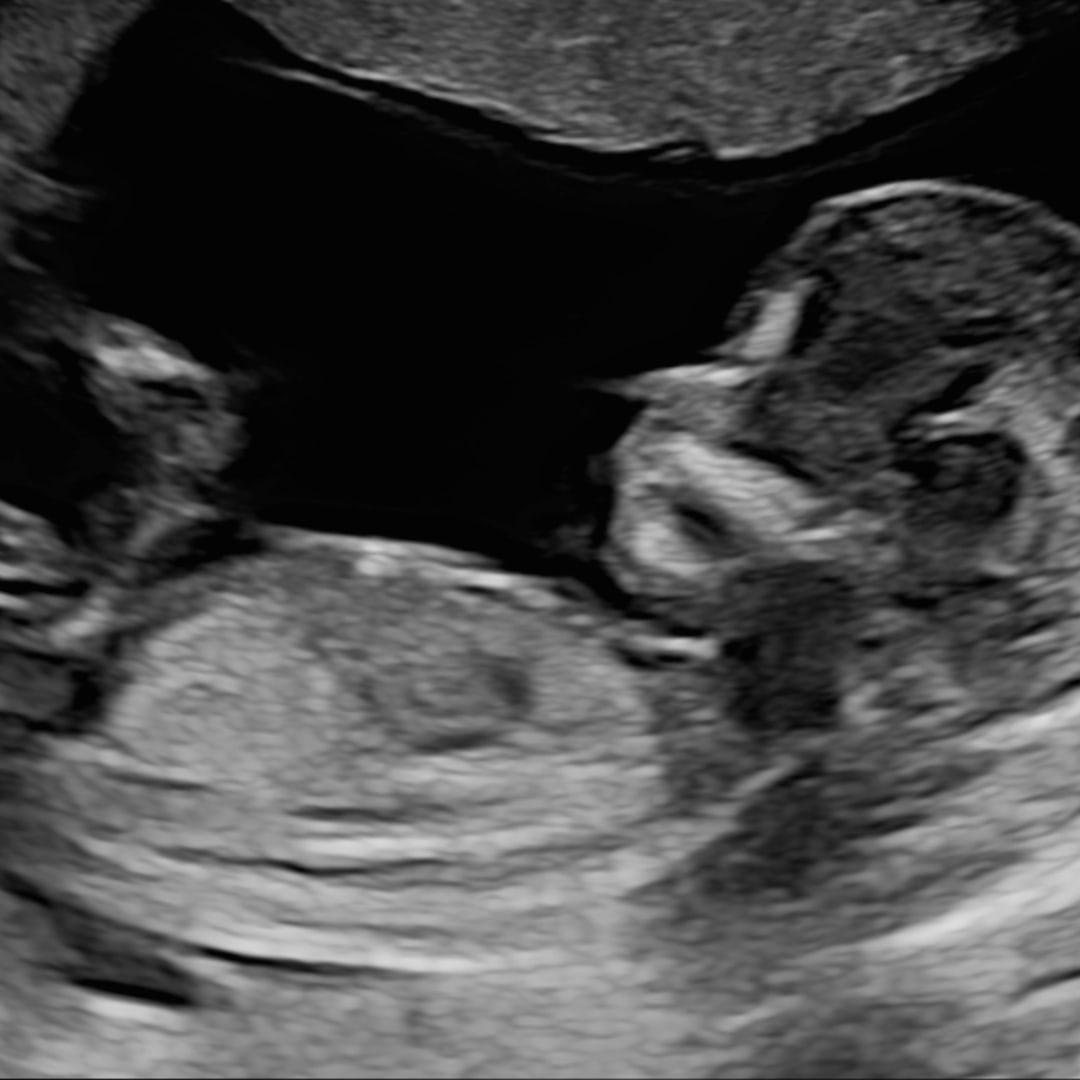 Photo shared by Hope for their Babylist baby registry.