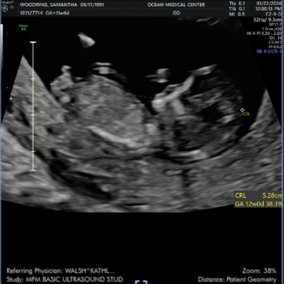 Photo shared by Samantha for their Babylist baby registry.