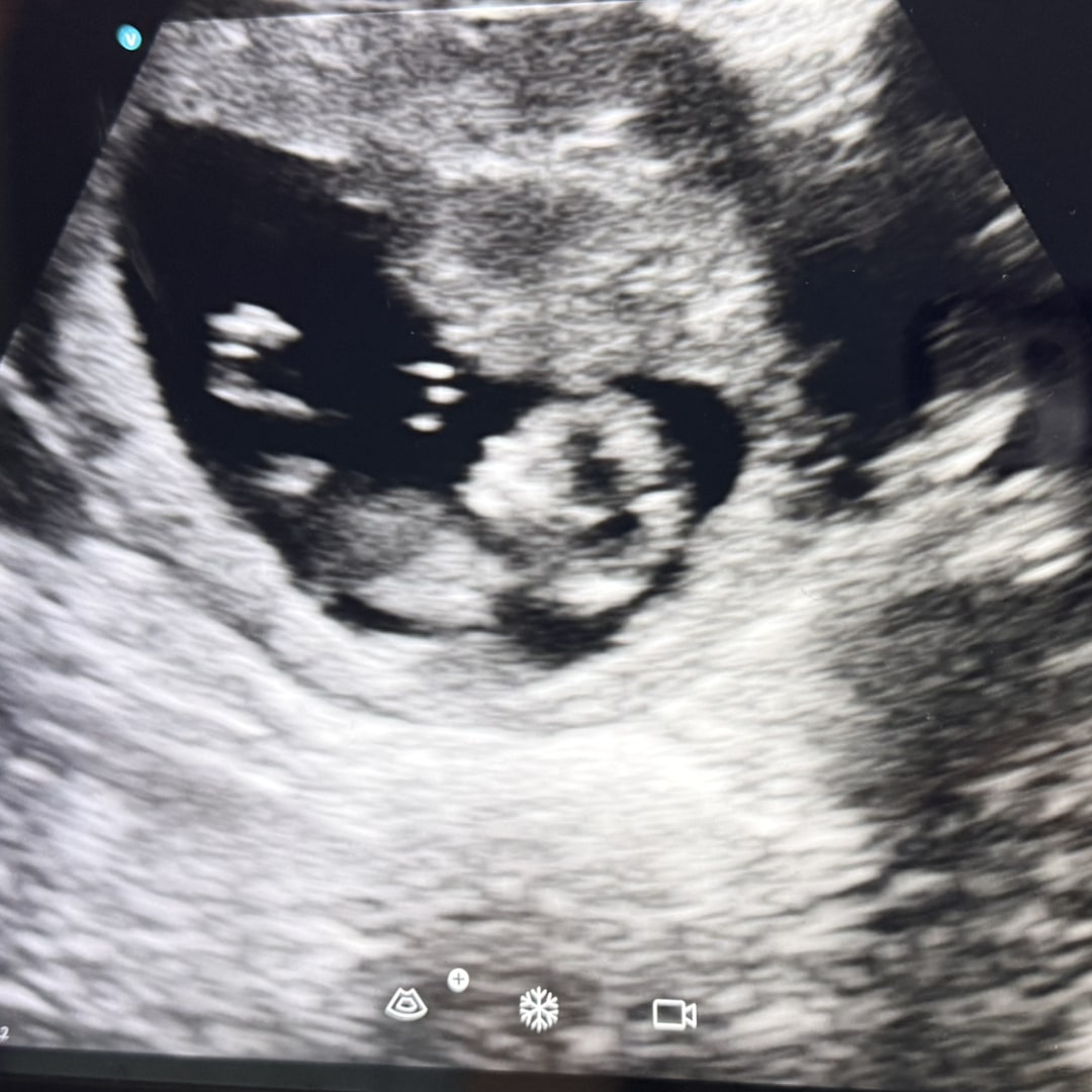 Photo shared by Jamie for their Babylist baby registry.
