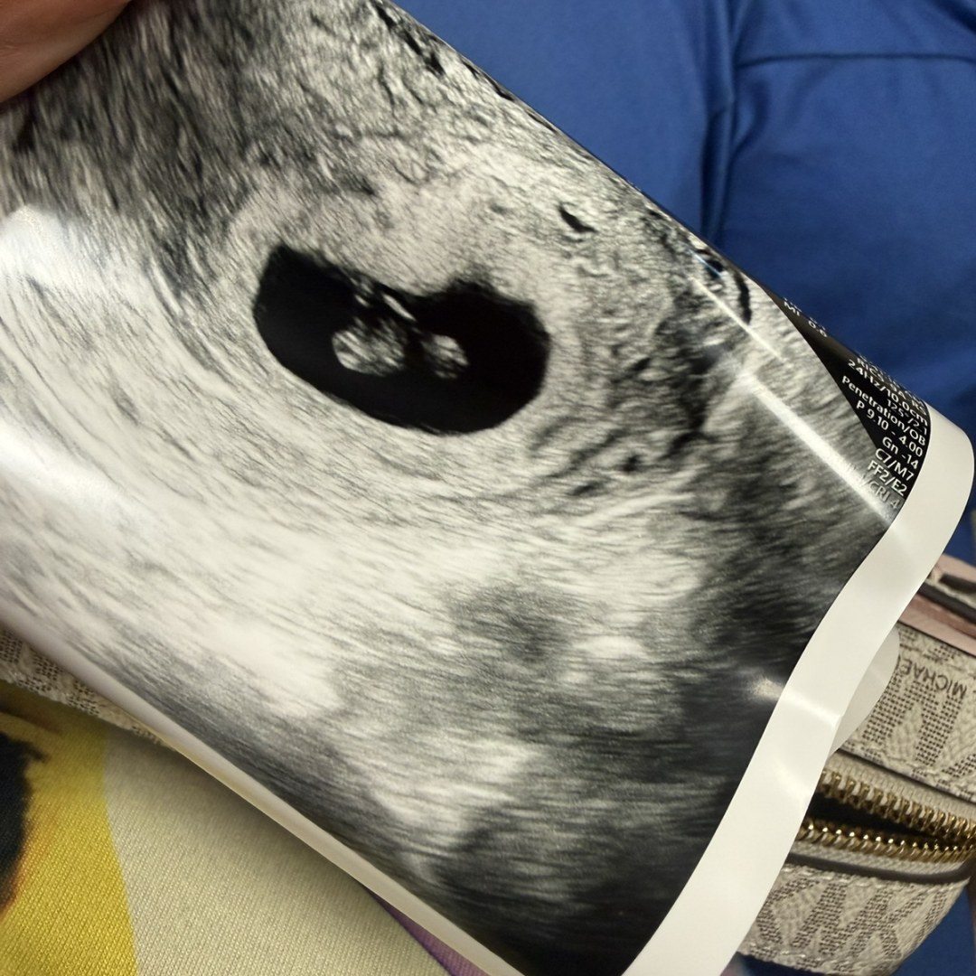 Photo shared by Necie for their Babylist baby registry.