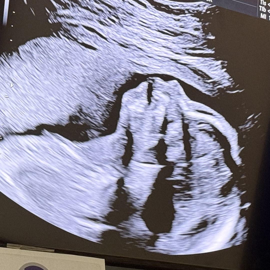 Photo shared by Amanda for their Babylist baby registry.