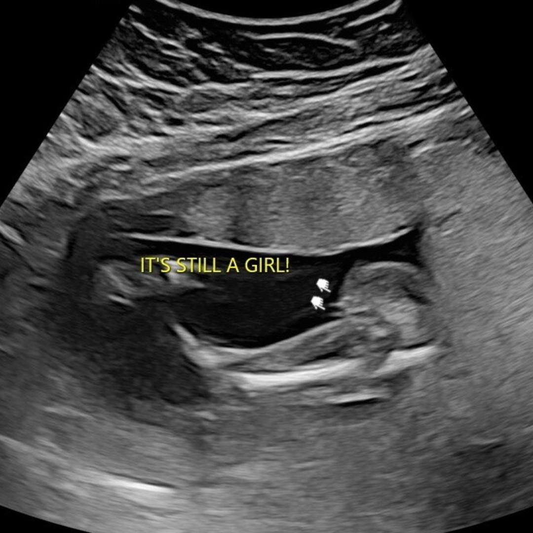 Photo shared by Dani for their Babylist baby registry.