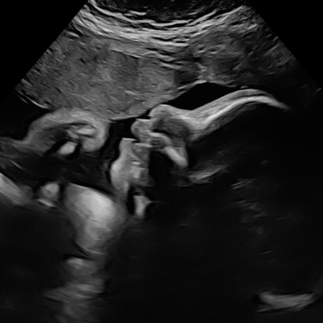 Photo shared by Melissa for their Babylist baby registry.