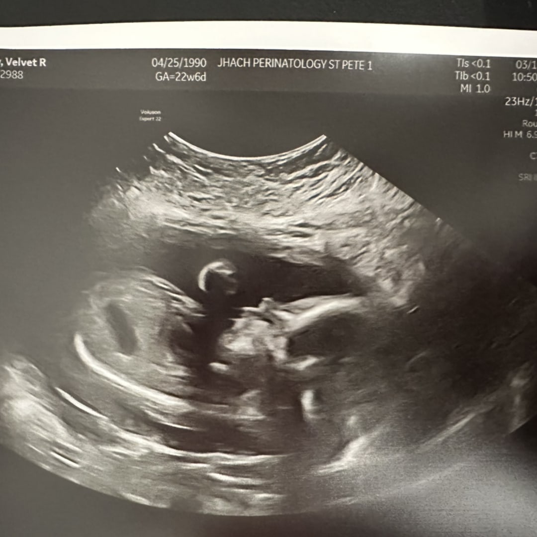 Photo shared by Vee for their Babylist baby registry.