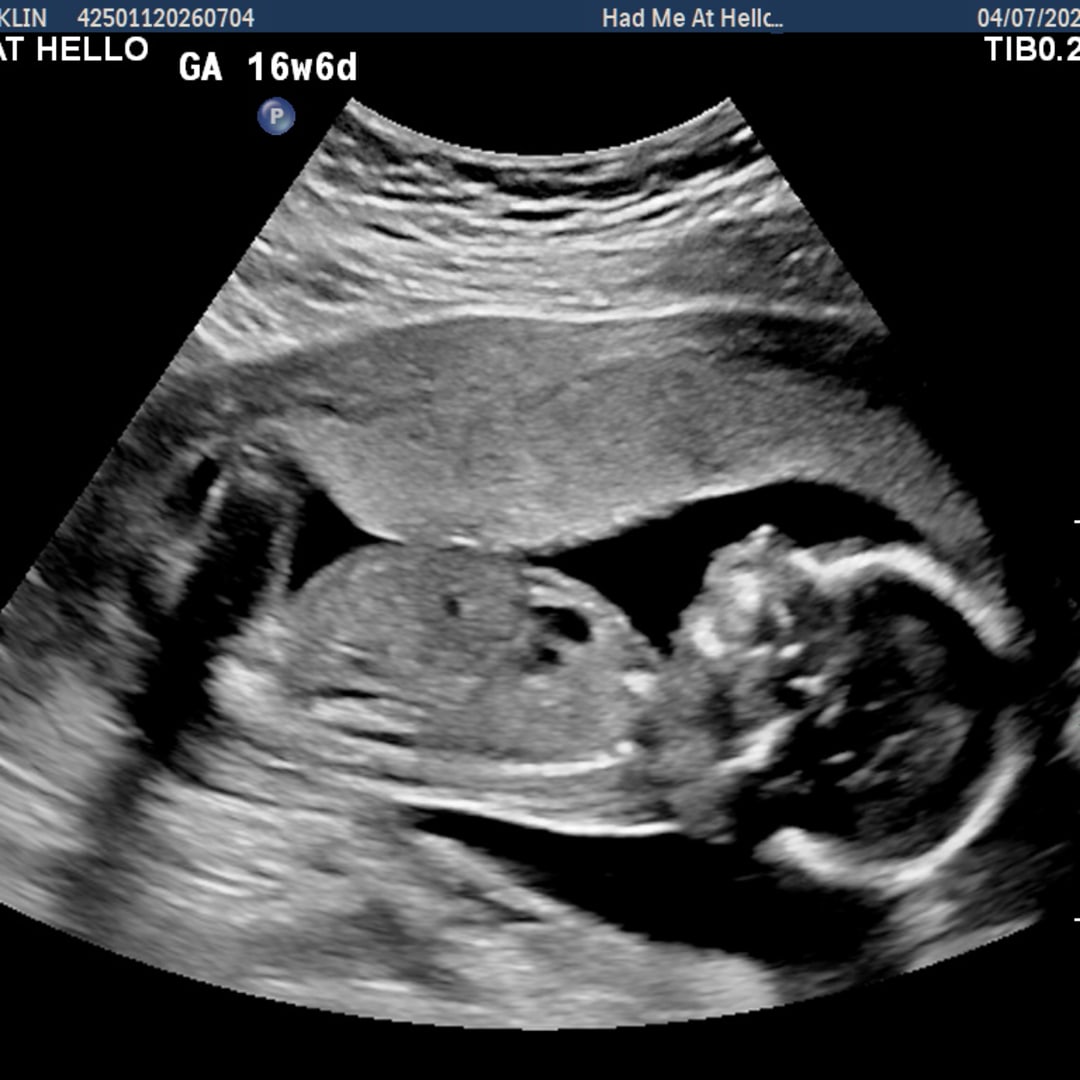 Photo shared by Annabel for their Babylist baby registry.