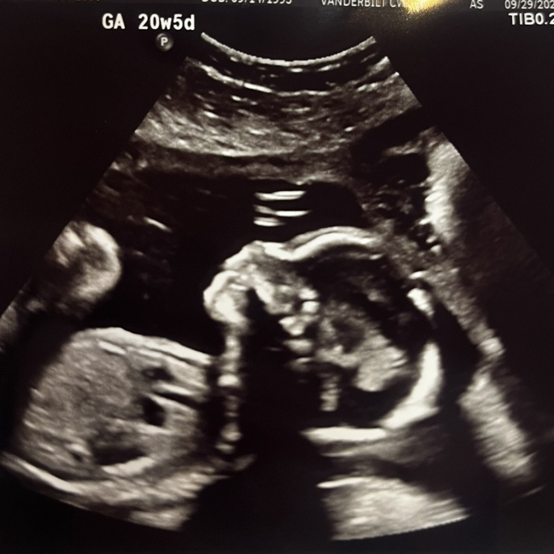 Photo shared by Jessica for their Babylist baby registry.