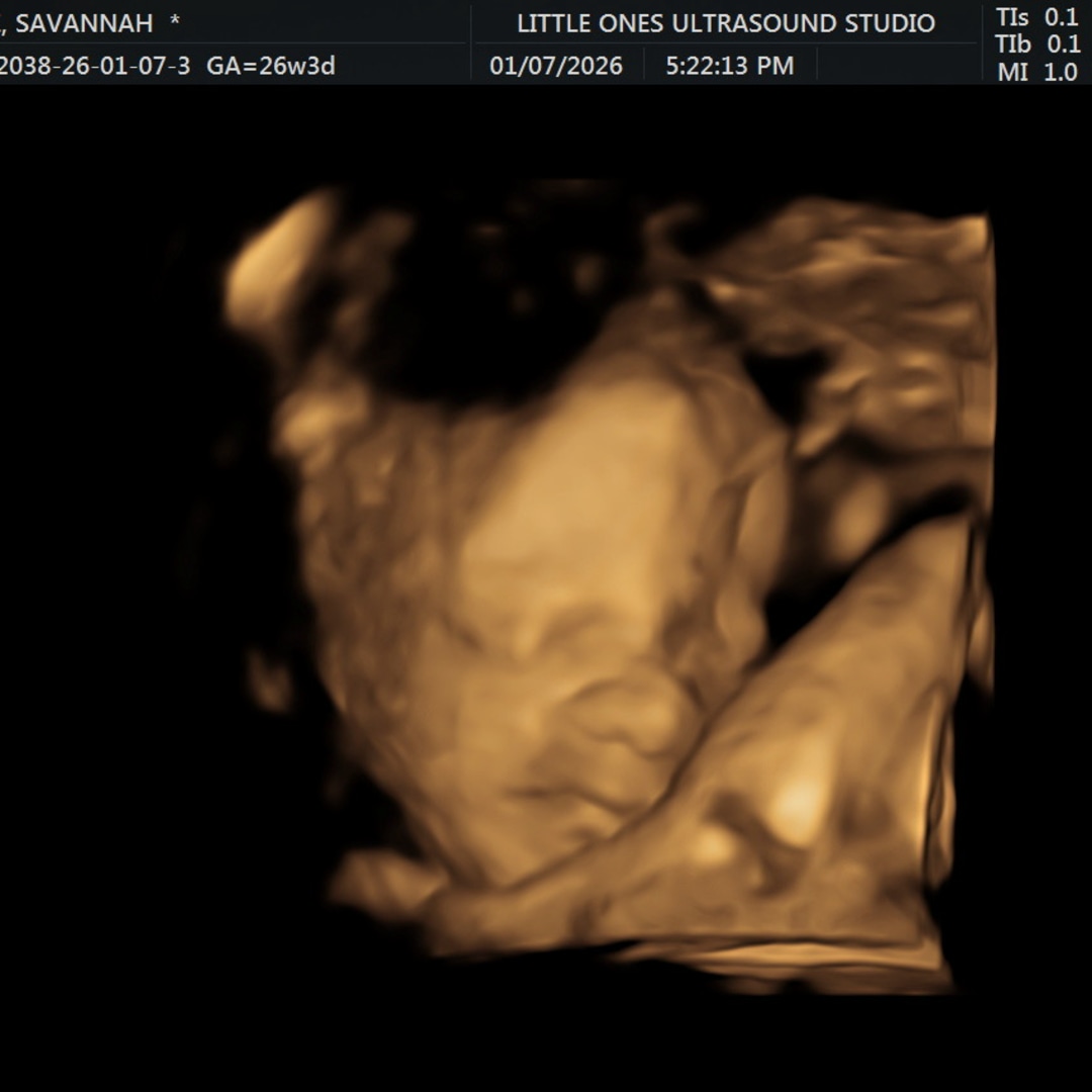 Photo shared by Savannah for their Babylist baby registry.