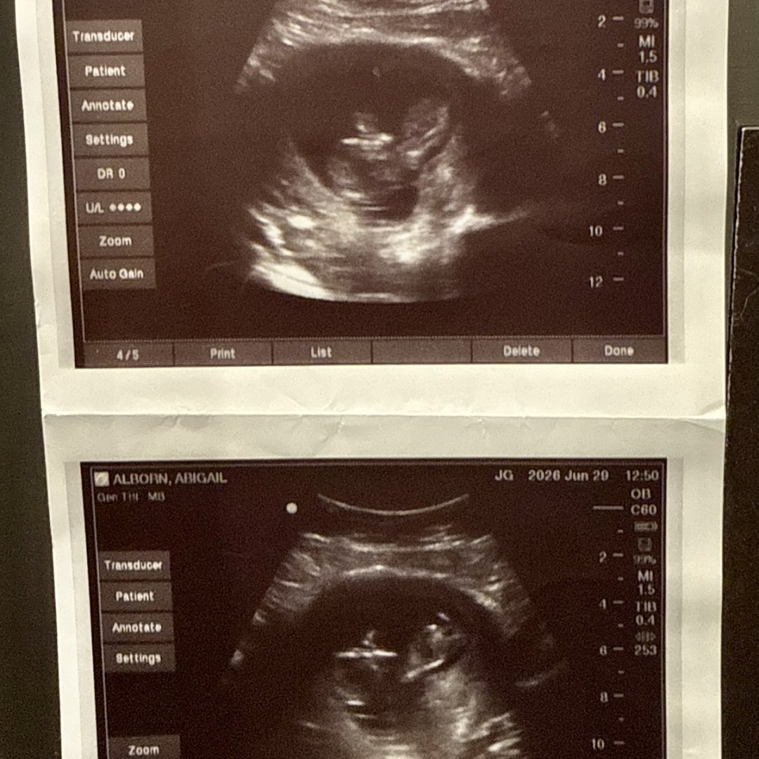 Photo shared by Abby for their Babylist baby registry.