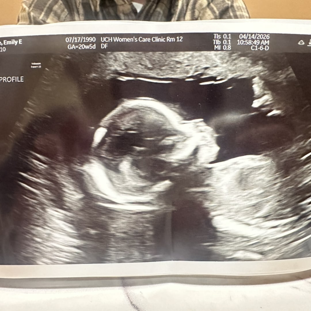 Photo shared by Emily for their Babylist baby registry.