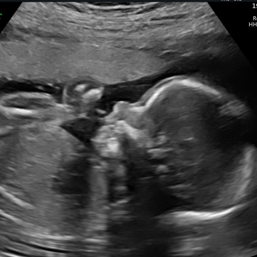 Photo shared by Christi for their Babylist baby registry.
