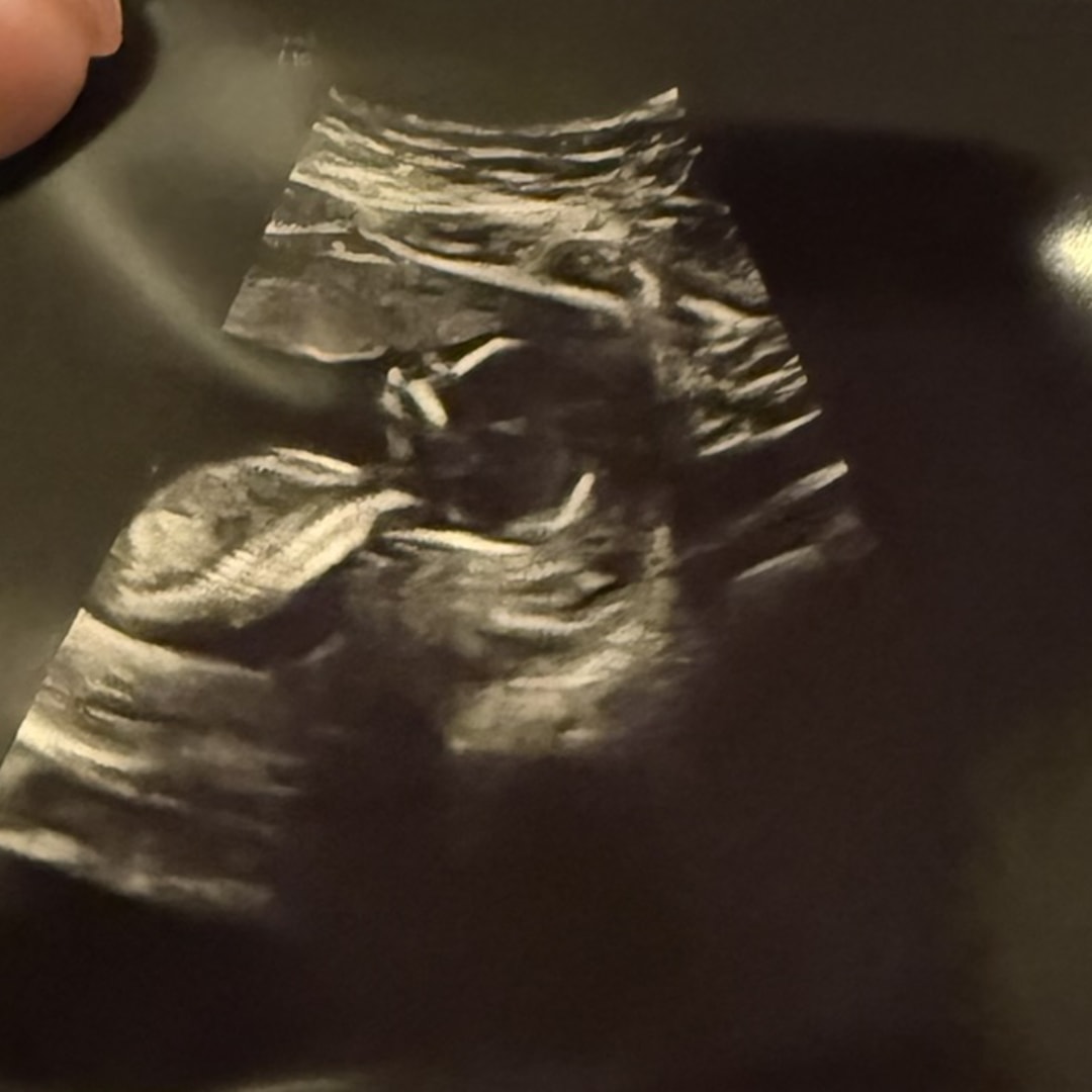 Photo shared by Emily for their Babylist baby registry.