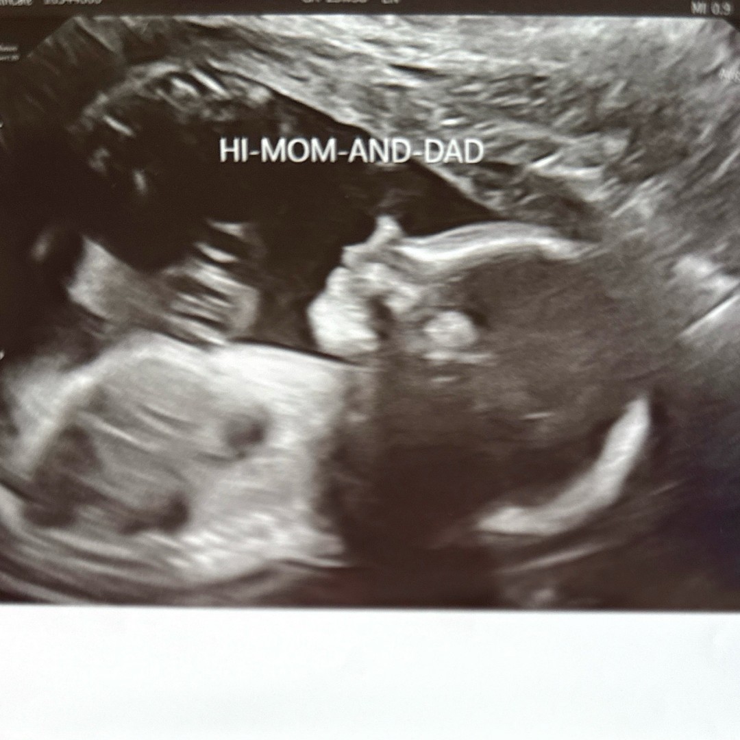 Photo shared by Hali for their Babylist baby registry.