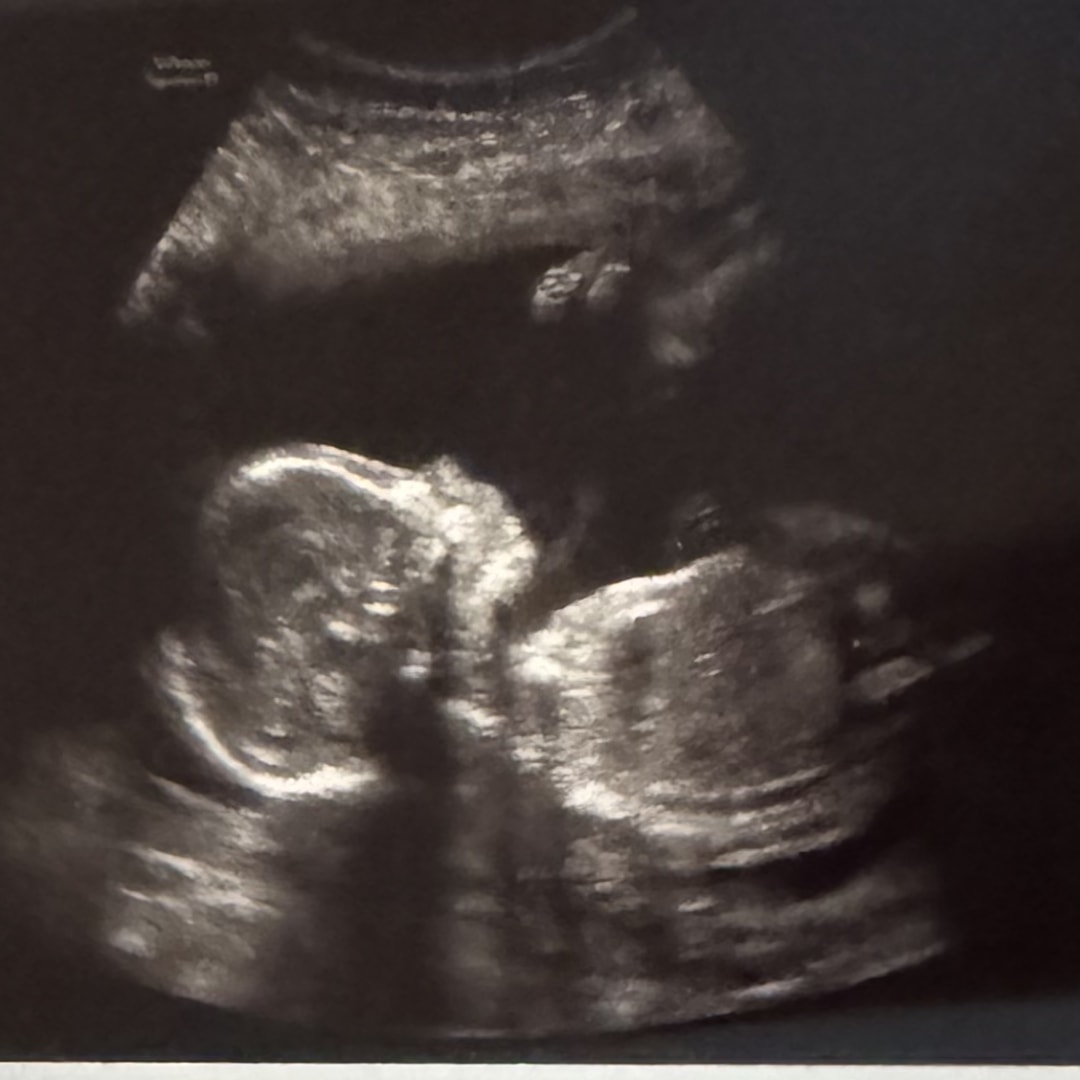 Photo shared by Elizabeth for their Babylist baby registry.